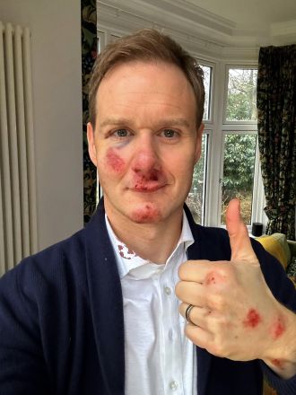 Sally Nugent and Jon Kay of BBC Breakfast reached out to Dan Walker after learning of his horrific bike crash. They sent him a message of support and encouragement.