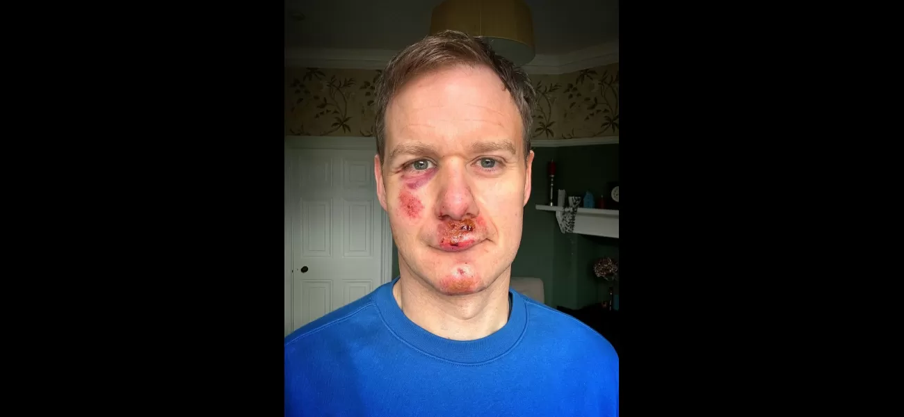 Dan Walker has announced that he will be returning to television after a serious cycling accident that left him injured.