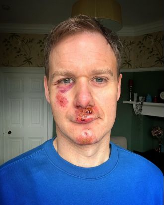 Dan Walker has announced that he will be returning to television after a serious cycling accident that left him injured.