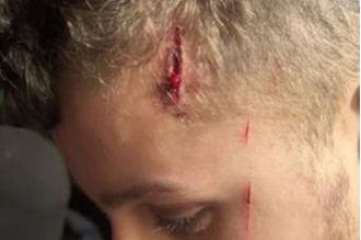 A 17-year-old boy was attacked at a house party, leaving him with facial lacerations.