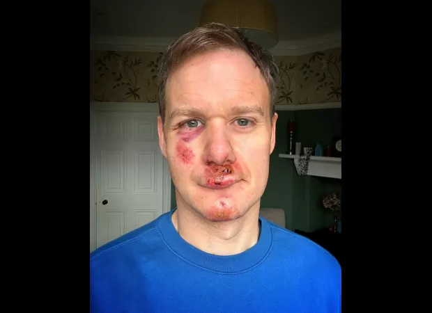 Dan Walker has announced that he will be returning to television after a serious cycling accident that left him injured.