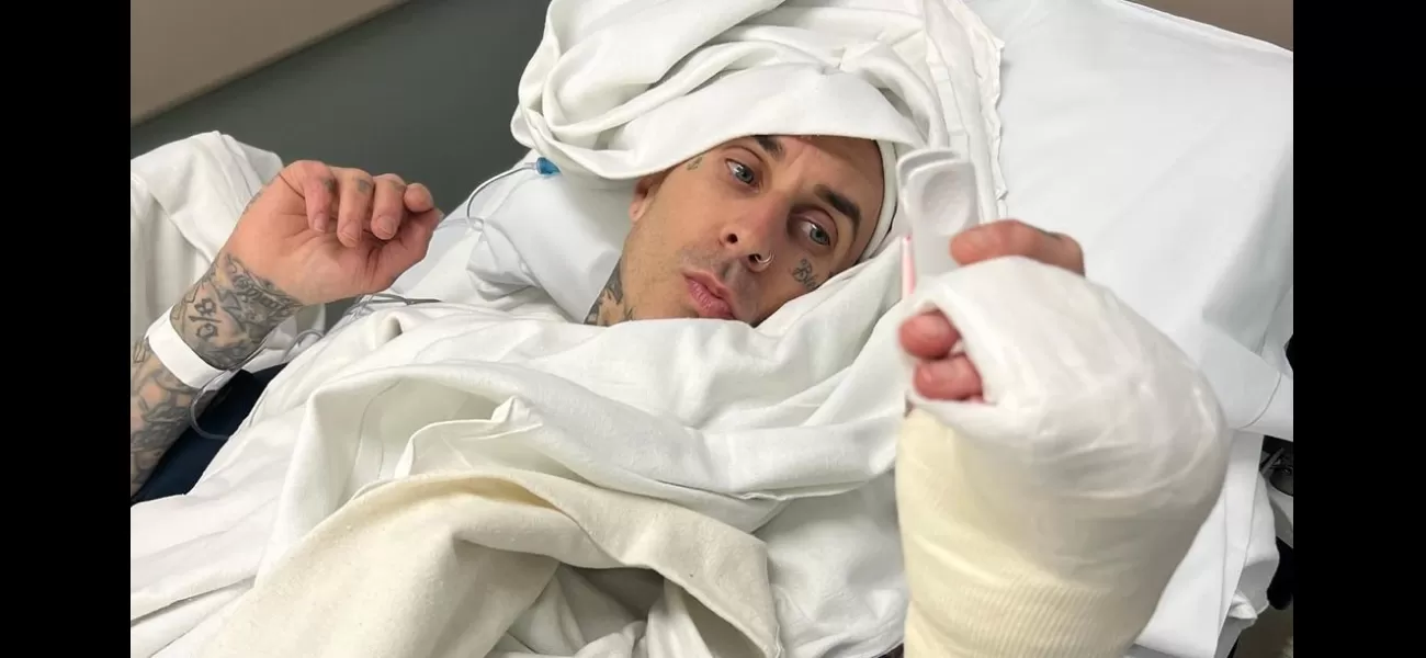 Travis Barker posted a very disturbing image of his finger during surgery, and informed fans that he had to cancel performances due to the injury.