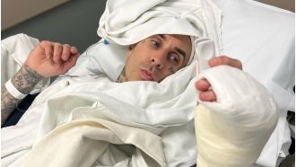 Travis Barker posted a very disturbing image of his finger during surgery, and informed fans that he had to cancel performances due to the injury.