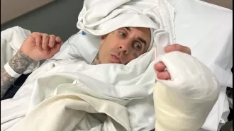 Travis Barker posted a very disturbing image of his finger during surgery, and informed fans that he had to cancel performances due to the injury.