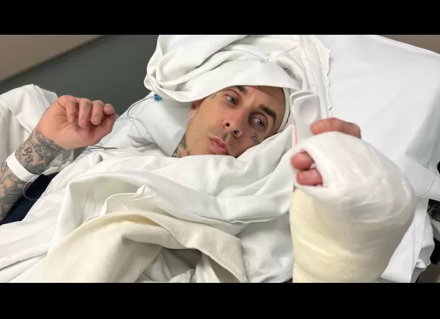 Travis Barker posted a very disturbing image of his finger during surgery, and informed fans that he had to cancel performances due to the injury.