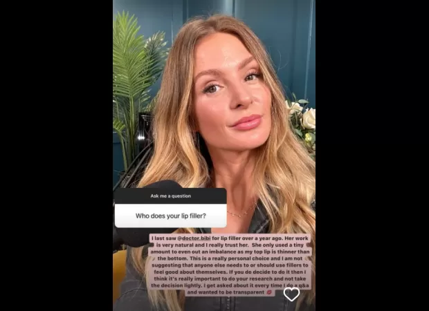 Millie Mackintosh opened up about her lip fillers and other 