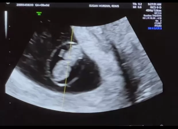 Brody and Tia are engaged and expecting their first child.