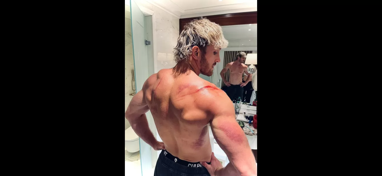 Logan Paul displays the horrific damage caused by a failed WWE stunt in London.