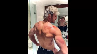 Logan Paul displays the horrific damage caused by a failed WWE stunt in London.