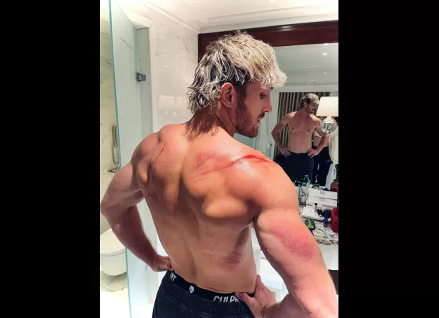 Logan Paul displays the horrific damage caused by a failed WWE stunt in London.