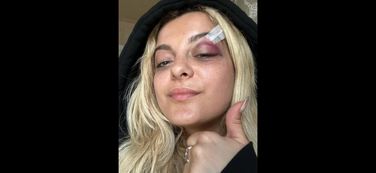 Drake is the latest person to be hit by a phone thrown at them on stage.