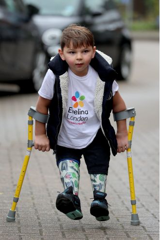 Alison apologizes for not having young amputee join charity climb: 