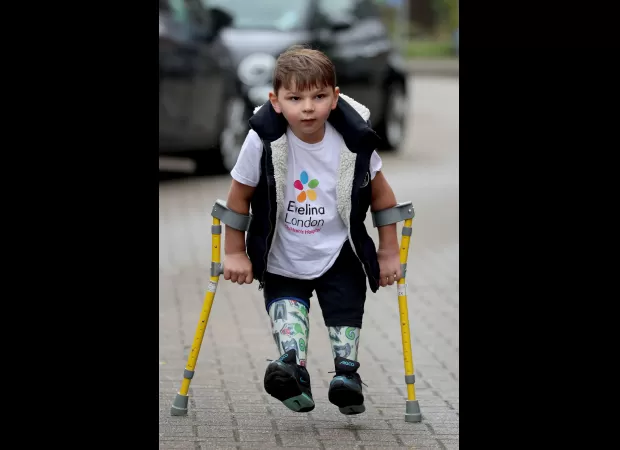 Alison apologizes for not having young amputee join charity climb: 