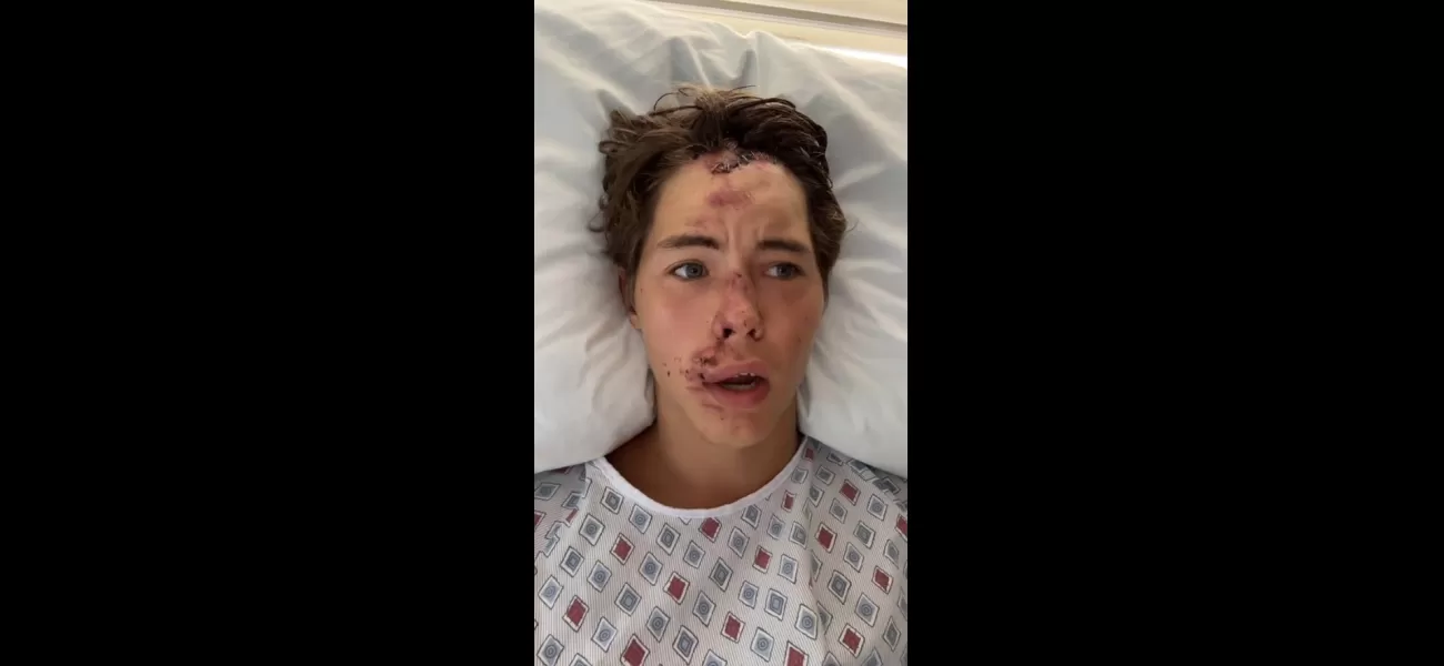 TikTok star feared death after falling onto lava rocks in Hawaii.