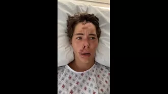 TikTok star feared death after falling onto lava rocks in Hawaii.