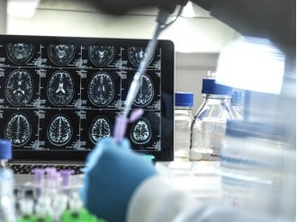 Scientists develop a device to detect Alzheimer's early, before symptoms appear.
