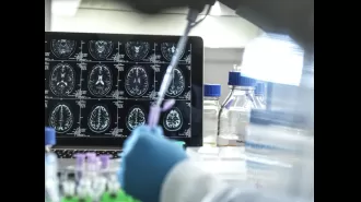 Scientists develop a device to detect Alzheimer's early, before symptoms appear.