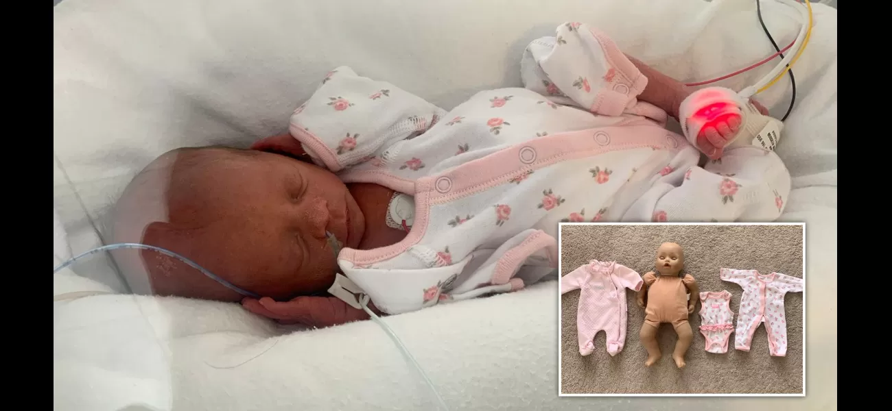 Premature baby, tiny enough to wear doll's clothes, defies expectations and survives.