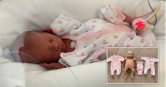 Premature baby, tiny enough to wear doll's clothes, defies expectations and survives.