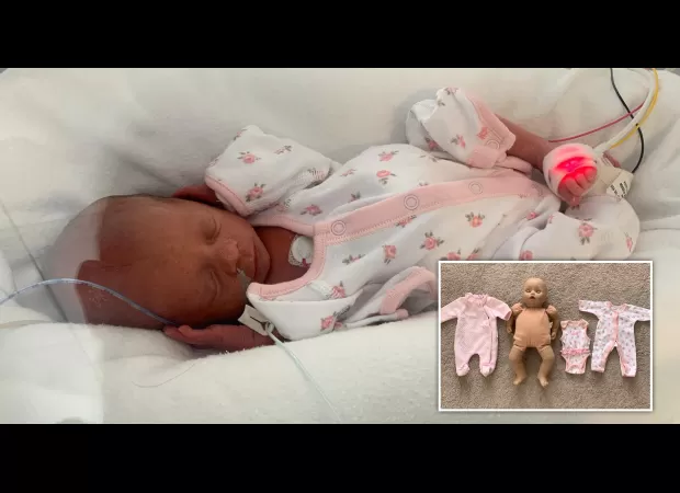 Premature baby, tiny enough to wear doll's clothes, defies expectations and survives.