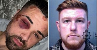 Police officer punched handcuffed autistic man seven times during arrest.