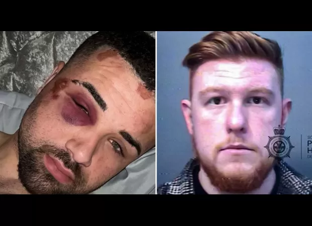 Police officer punched handcuffed autistic man seven times during arrest.