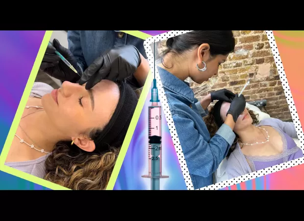 Joined others my age in getting Botox; here's what happened.