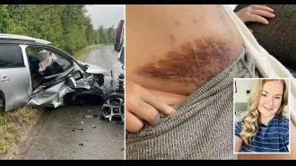 Mum involved in car crash while 38 weeks pregnant, resulting in large bruises on bump.