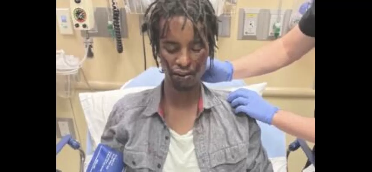 DOJ investigates police brutality 1 year after beating of Black homeless vet in Colorado.