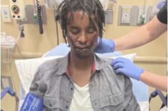 DOJ investigates police brutality 1 year after beating of Black homeless vet in Colorado.
