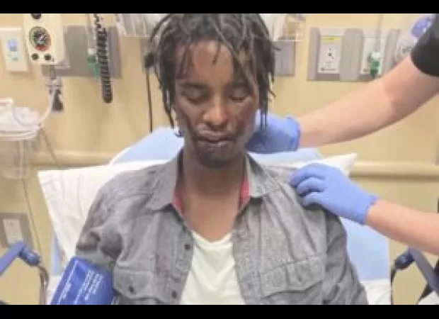 DOJ investigates police brutality 1 year after beating of Black homeless vet in Colorado.