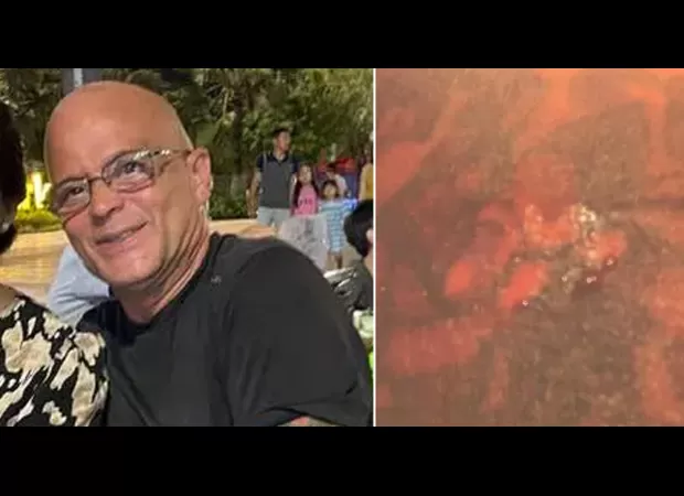 Passenger sues airline for burn injuries from spilled coffee on their tattoo.