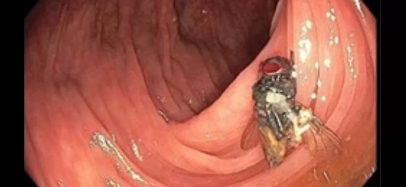 Doctors find mystery after discovering a live fly inside man's intestines.