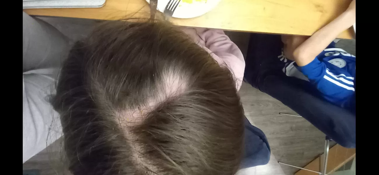Girl had clump of hair ripped out when trying to get receipt from ticket machine at arcade.