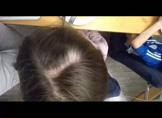 Girl had clump of hair ripped out when trying to get receipt from ticket machine at arcade.