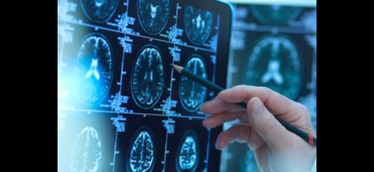 Blacks receive Alzheimer's imaging later in life than Whites, according to research.