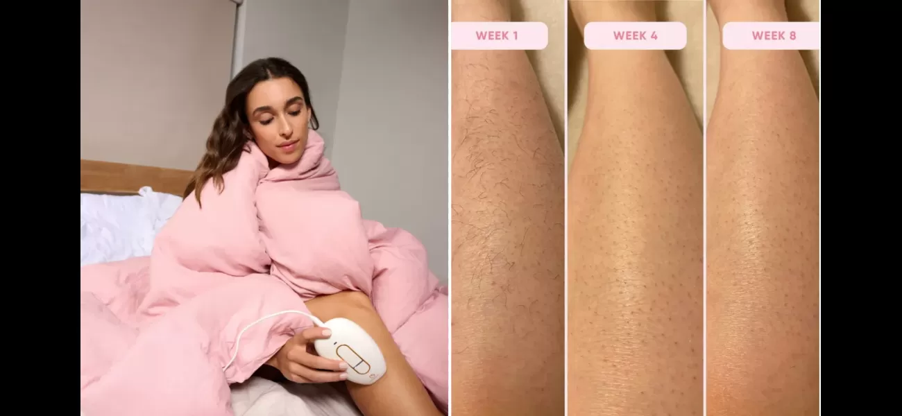 Save hundreds with this £136 device instead of laser hair removal.