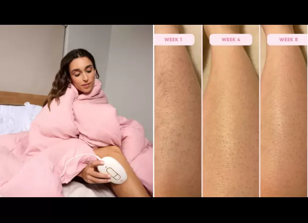 Save hundreds with this £136 device instead of laser hair removal.