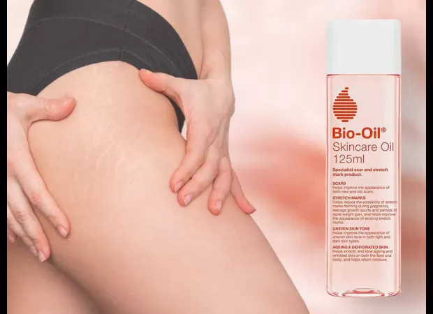 Say goodbye to scars! Get this body oil to reduce stretch marks and it's on sale now!