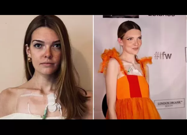 Dream job offer rescinded after disclosing disability.