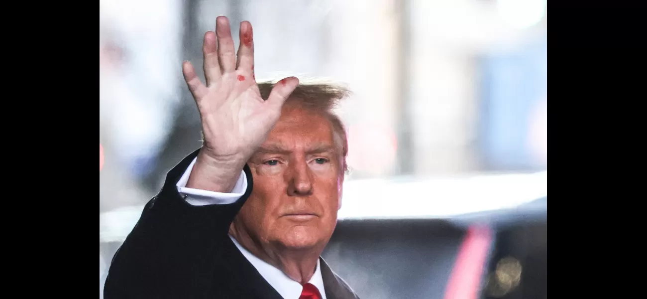 Trump explains reason for odd red marks on his hand.