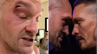 Boxer who slashed Tyson Fury denies elbowing him and says he has no regrets about delaying the fight.