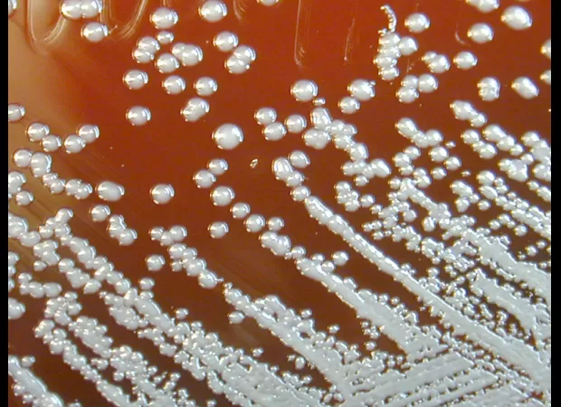 Dangerous bacteria in water kills two, urgent call for caution.