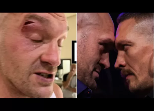 Boxer who slashed Tyson Fury denies elbowing him and says he has no regrets about delaying the fight.