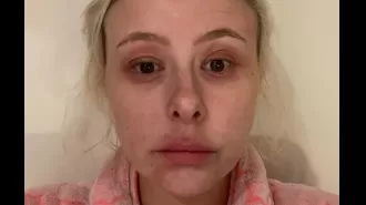 Eczema was a major issue for me, but I finally discovered a skincare regimen that has been incredibly effective.