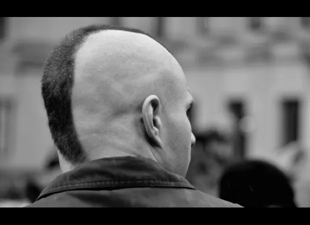 Using President Trump's tactics of fat-shaming, white supremacist groups are recruiting members for a potential race war.