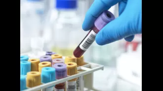 A blood test may soon detect heart failure risk.