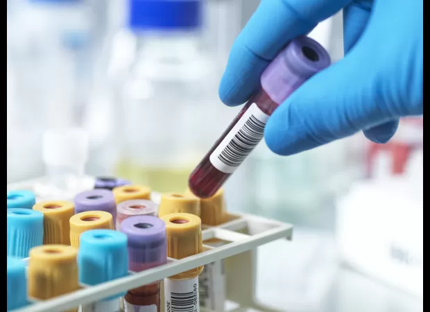 A blood test may soon detect heart failure risk.