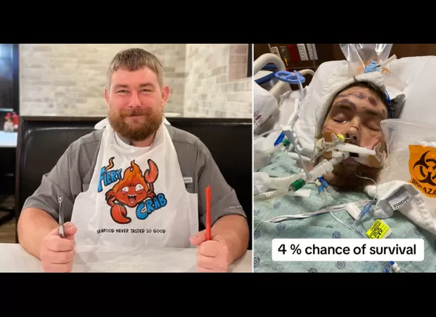 A man's ingrown hair caused him to become 'brain dead' and he had a slim 4% chance of survival.