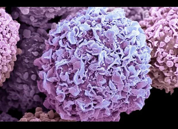 Potential new treatment for breast cancer aims to prevent recurrence by targeting dormant cells that can cause relapses.